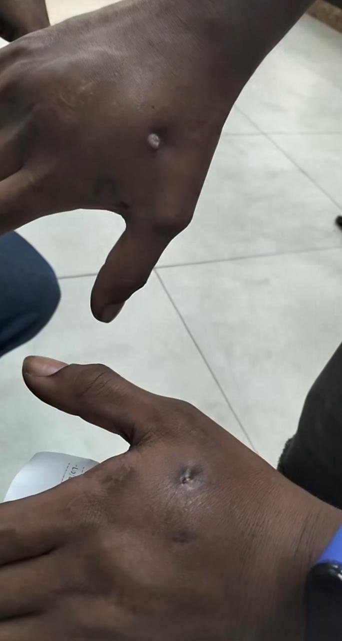 ULGO, BALEADO — UMA HISTÓRIA DE RECOMEÇO