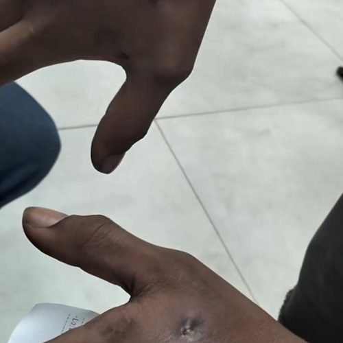 ULGO, BALEADO — UMA HISTÓRIA DE RECOMEÇO